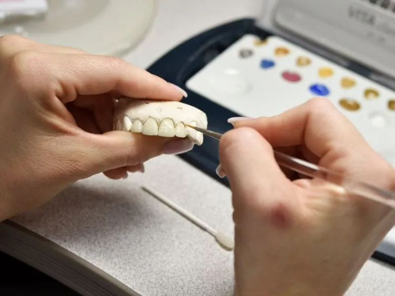 Labo răng sứ hay còn gọi là phòng lab nha khoa
