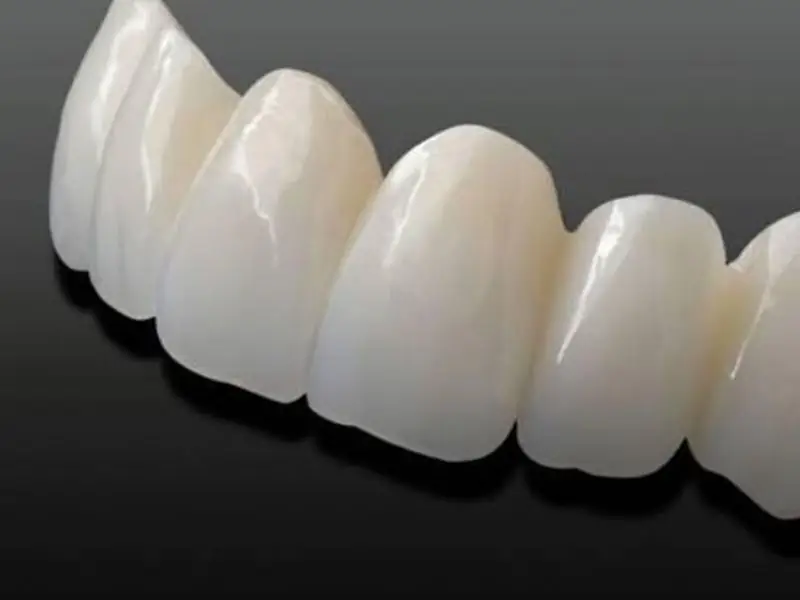 Răng sứ Cercon có nguồn gốc từ Đức