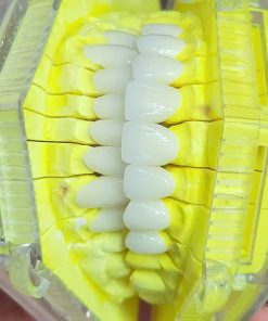 Răng sứ Cercon HT – Đức
