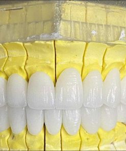 Răng sứ Orodent Zirconia – Italy